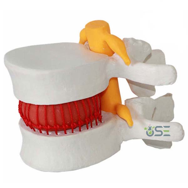 Human Lumbar Vertebrae