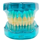 Orthodontic Dental Model